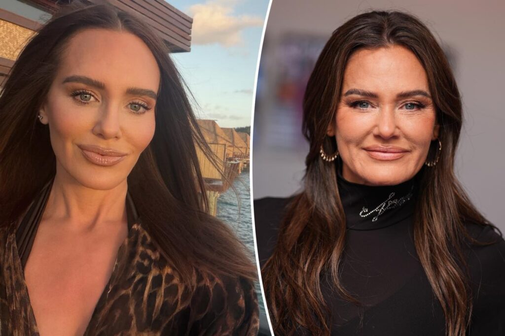 Meredith Marks shares details on her facelift