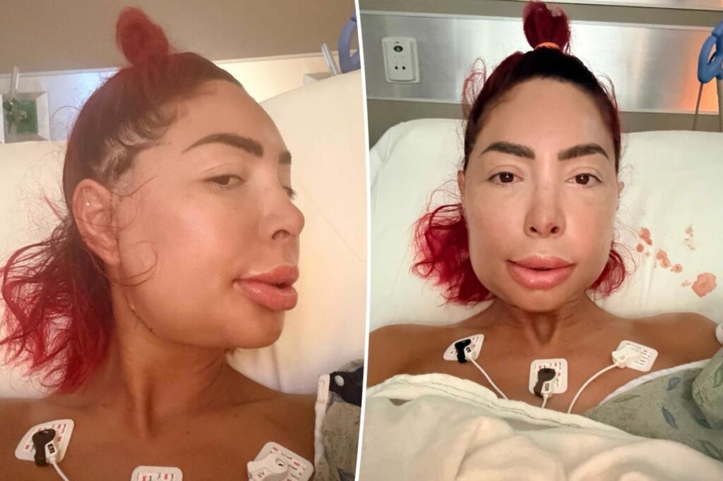 Farrah Abraham unrecognizable after jaw surgery leaves face severely swollen