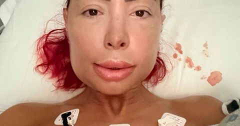 Teen Mom’s Farrah Abraham Undergoes Jaw Surgery, Shows Intense Swelling Amid Liquid Diet Recovery