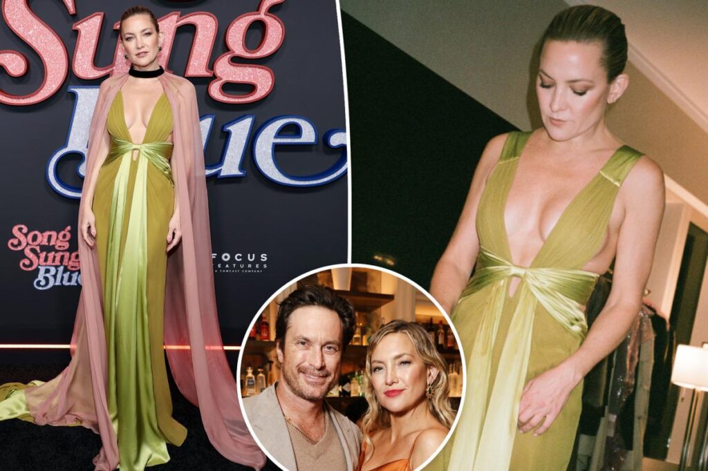 Oliver Hudson pokes fun at sister Kate Hudson’s plunging red carpet Valentino dress