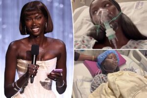 Supermodel Anok Yai, 28, diagnosed with congenital defect that’s ‘destroying’ her lungs