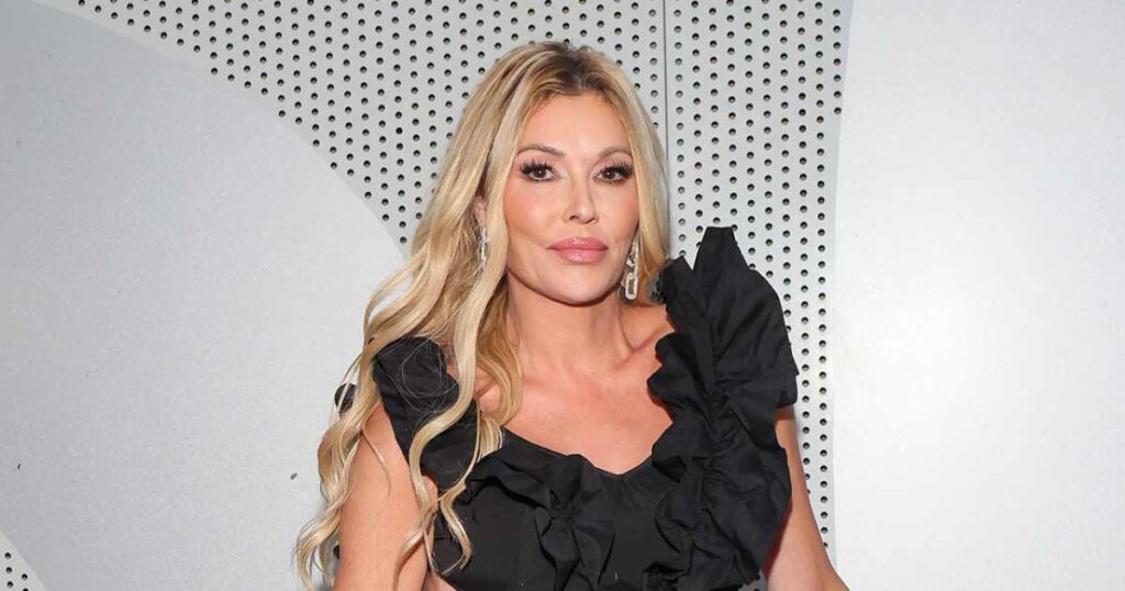 What Brandi Glanville Has Said About Her Facial Disfigurement: Treatments, Teeth and Diagnosis
