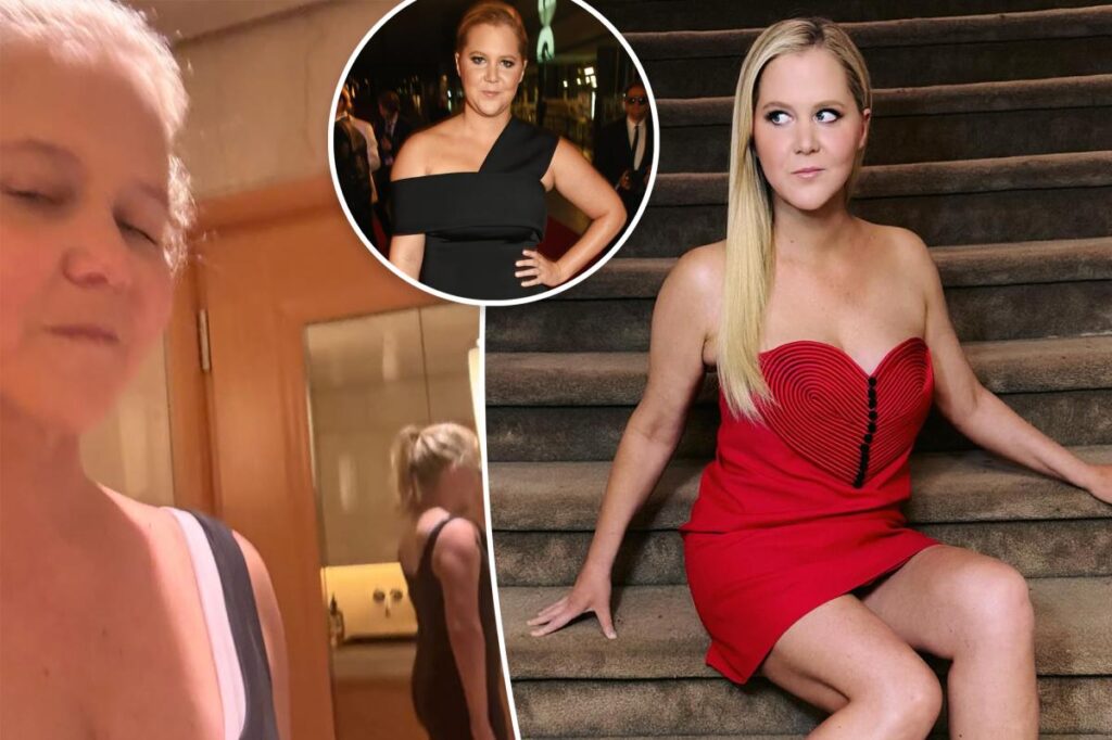 Amy Schumer shows off 50-pound weight loss in Skims selfie