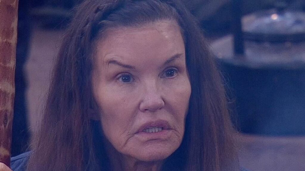 Janice Dickinson ‘claims she was on sleeping medication given to her by an ITV medic when she suffered horrific fall on I’m A Celeb as she pursues £700k lawsuit’