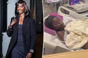 Supermodel Anok Yai, 28, undergoes ‘life-saving procedure’ due to sepsis following lung surgery
