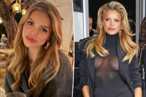 Brooks Nader dissolves lip fillers, sharing she is ‘feeling like my old self’