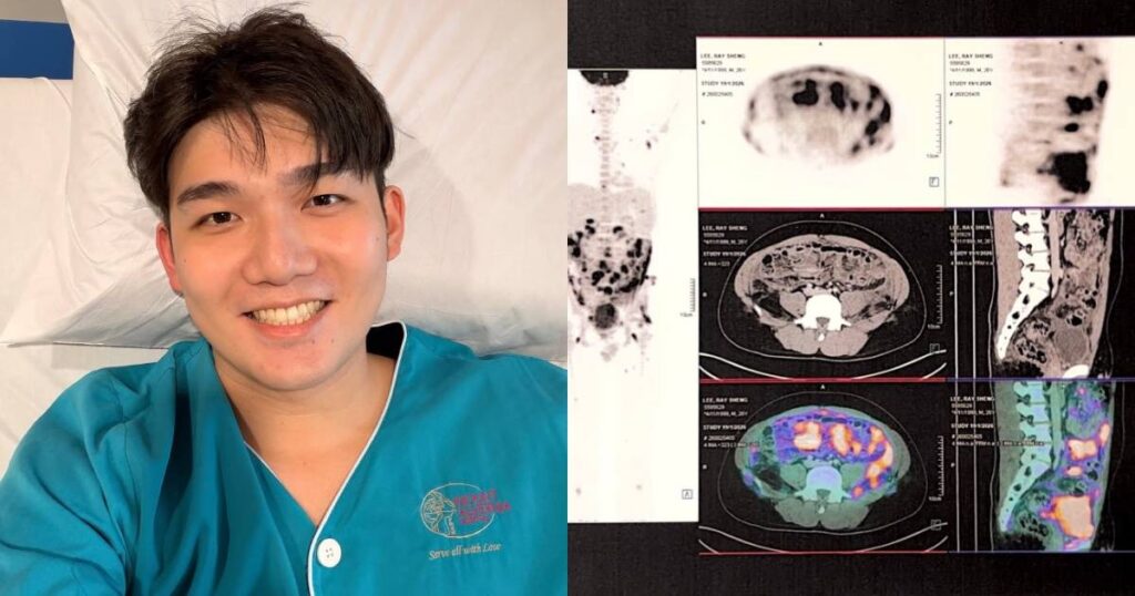 ‘It’s time to fight’: A Hot Hideout co-founder reveals he has stage 3 cancer, Lifestyle News