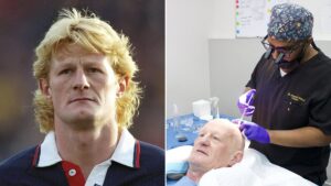EDEN CONFIDENTIAL: The bald truth… Football legend Colin Hendry to tell all about his hair loss and court case