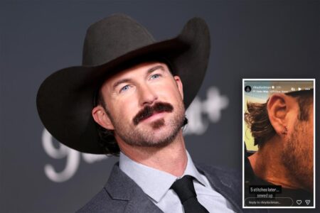 Riley Green left bleeding after fan hurls phone at country star onstage during concert