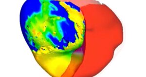 To fix a patient’s irregular heartbeat, doctors first tested its digital ‘twin’ , Lifestyle News