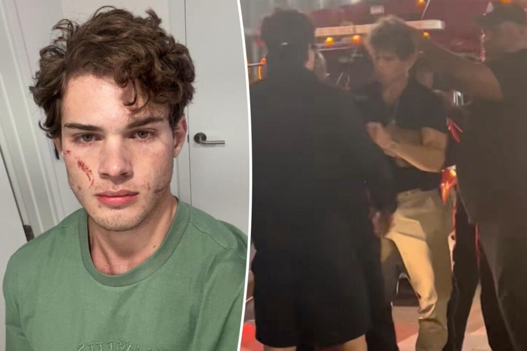 ‘Looksmaxxing’ influencer Clavicular addresses ‘brutal’ hospitalization after suspected overdose on livestream