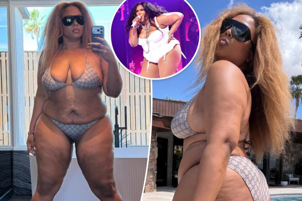 Lizzo shows off 60-pound weight loss with new bikini pics