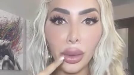 Farrah Abraham now unable to fully open her mouth… after spending almost $1million on cosmetic surgery