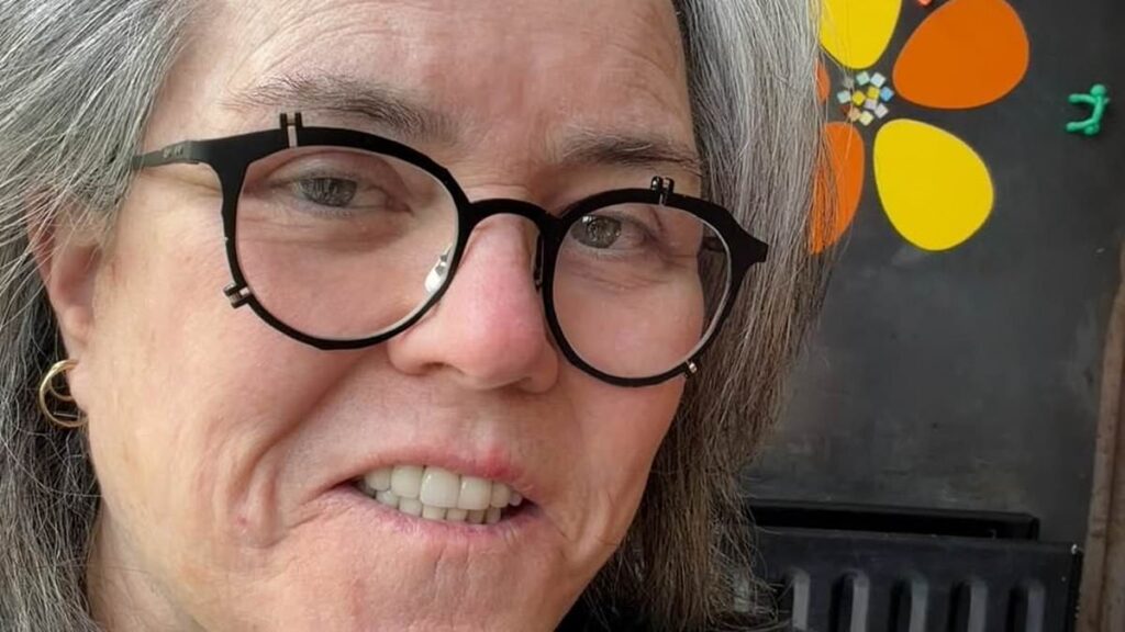 Rosie O’Donnell, 64, reveals ‘shameful’ secret facelift… after branding surgery a ‘betrayal of feminism’