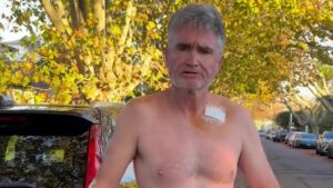 Dave Hughes displays his bandages after having FIVE skin cancers removed and undergoing 45 stitches