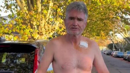 Dave Hughes displays his bandages after having FIVE skin cancers removed and undergoing 45 stitches