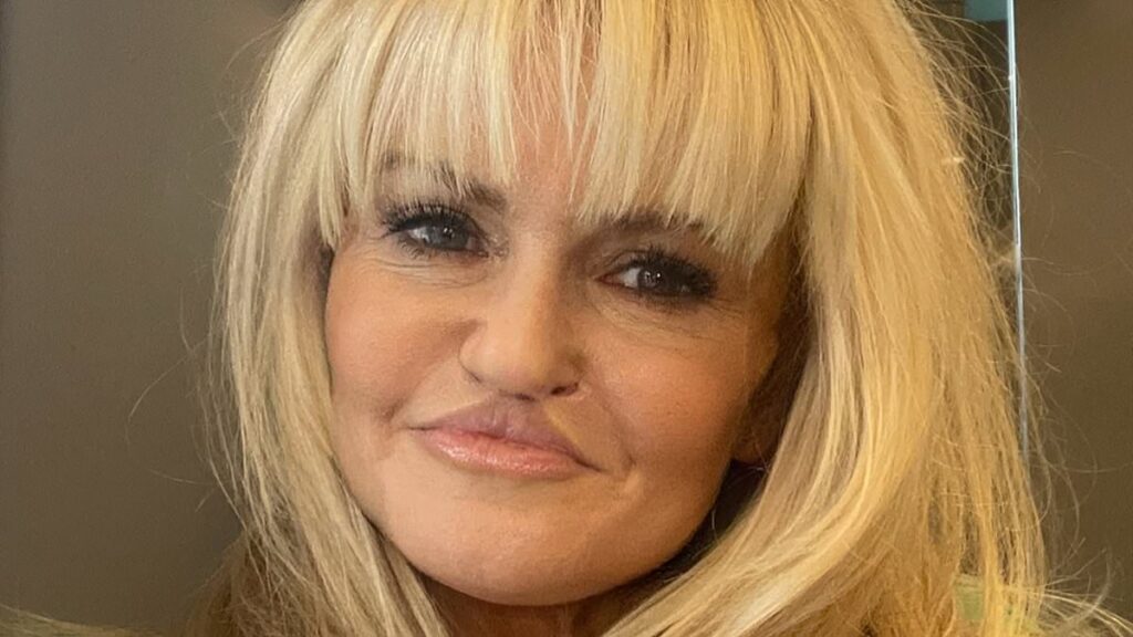 Danniella Westbrook shares latest picture of her face as she prepares to have corrective surgery on her lip