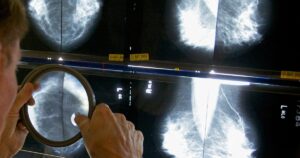 When should you get a mammogram? Conflicting advice makes it hard to know, Lifestyle News