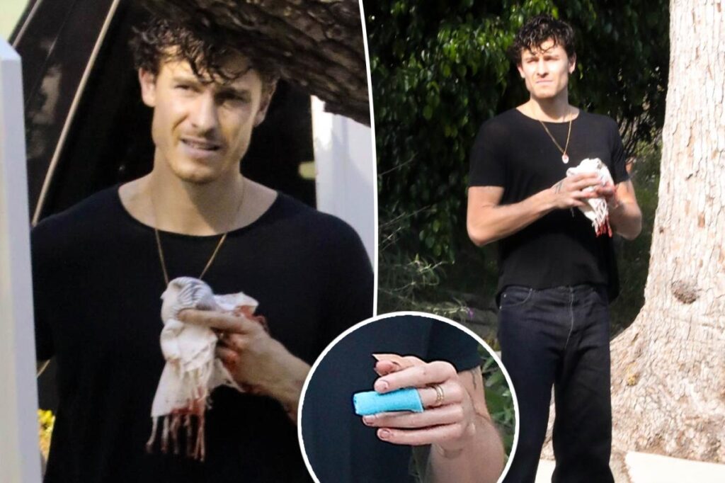 Shawn Mendes suffers bloody hand injury in gruesome pics