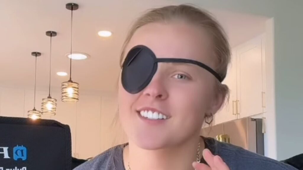 JoJo Siwa reveals she’s battling concussion and a nasty eye infection and has been forced to go on ‘couch and bed rest’ after being thrown off a golf cart in terrifying accident