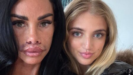 Katie Price shows off her swollen and bruised lips as she reunites with her daughter Princess after undergoing surgery to remove scar tissue caused by migrated filler