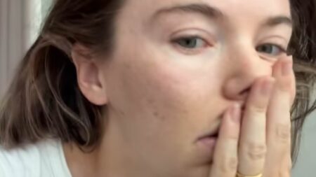 Georgia Toffolo gets candid about her 17-year acne battle as she reveals another skin concern in Instagram vs reality clip after looking ‘perfect’ at Ascot