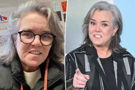 Rosie O’Donnell reveals whether she’ll undergo more plastic surgery after facelift
