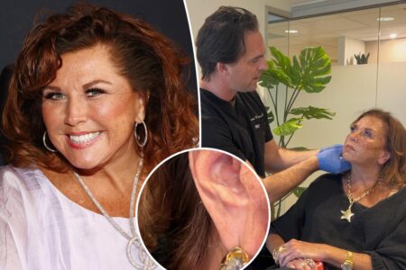 Abby Lee Miller shows off ‘amazing’ $1K ear rejuvenation surgery results
