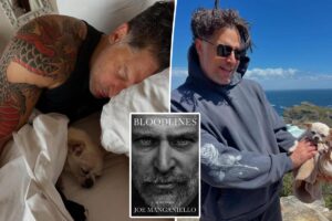 Joe Manganiello reveals life-threatening health battle resulting in ‘amputation’