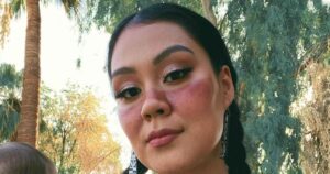 Influencer Siera Amaya Underwent ‘Life-Saving’ Emergency Surgery After Ruptured Ectopic Pregnancy