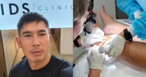 Elvin Ng gets steroid shots after allergic reaction to sandfly bites from months ago, Entertainment News