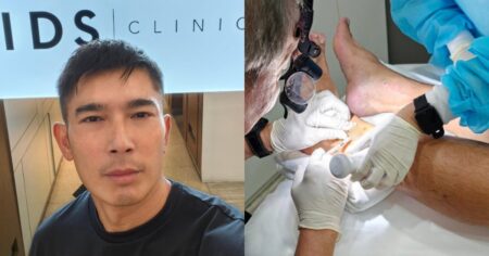 Elvin Ng gets steroid shots after allergic reaction to sandfly bites from months ago, Entertainment News