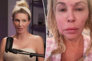 Brandi Glanville reveals latest health scare as facial parasite woes rage on