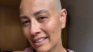 Melanie Sykes proudly shows off her bald head as a ‘Monday motivation’ after losing ‘two-thirds’ of her hair during alopecia battle