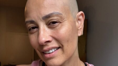 Melanie Sykes proudly shows off her bald head as a ‘Monday motivation’ after losing ‘two-thirds’ of her hair during alopecia battle