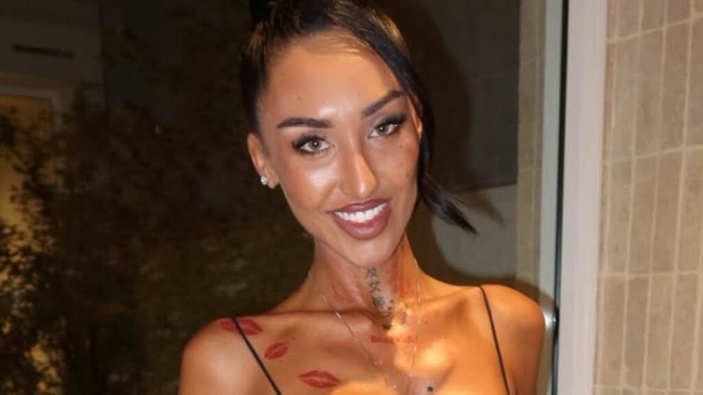 Fans share health fears for Australian influencer as she reveals the ‘insane’ results of the controversial Bali ‘Barbie Waist’ surgery