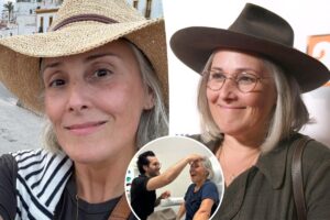 Ricki Lake shares unfiltered before-and-after photos to mark 2 years since facelift