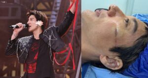 Wang Leehom receives 39 stitches on face and left ear after tripping on stage at China concert