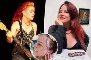 L7 rocker Jennifer Finch reveals aggressive cancer diagnosis, shows brain surgery scar