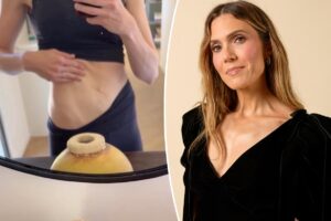Mandy Moore gives unfiltered look at postpartum body, ‘loose skin’ after 3 kids