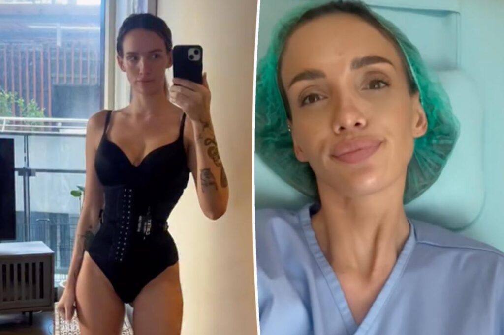 Bravo alum shares results of ‘rib recontouring’ procedure to get ‘snatched waist’