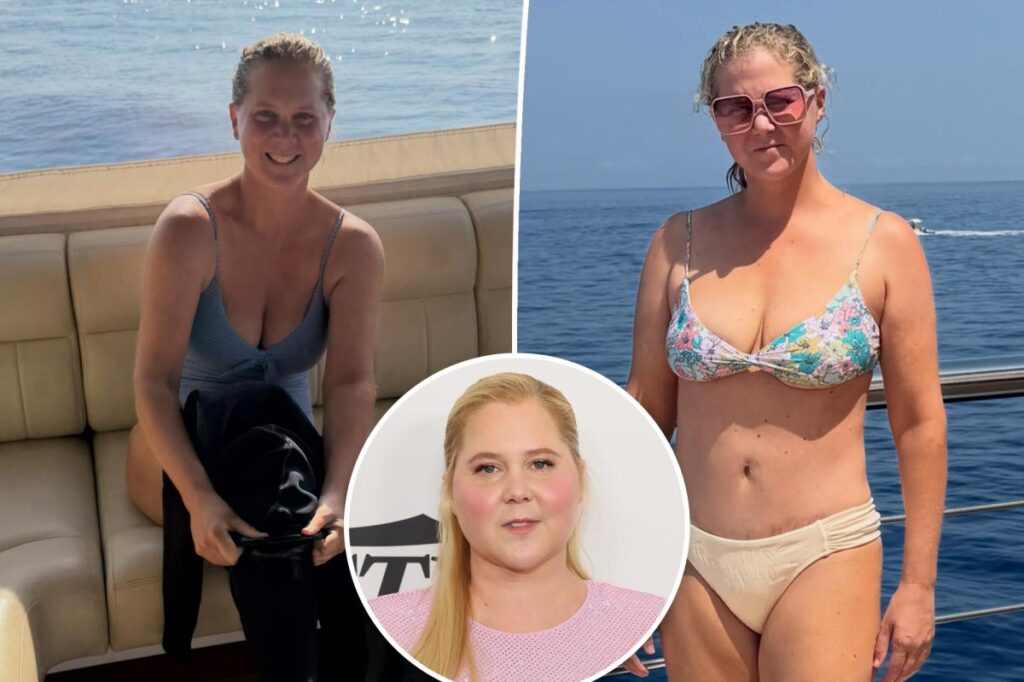 Bikini-clad Amy Schumer shows off dramatic weight loss in new unfiltered photos