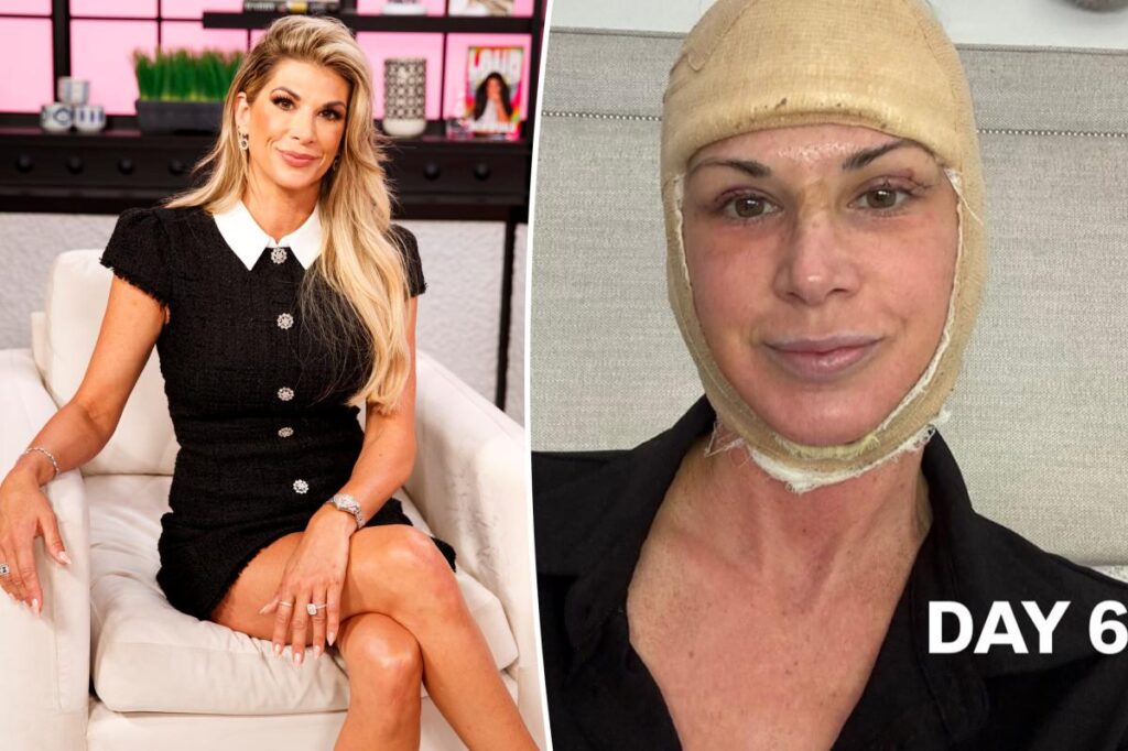 ‘RHOC’ alum Alexis Bellino treats herself to facelift ahead of 50th birthday