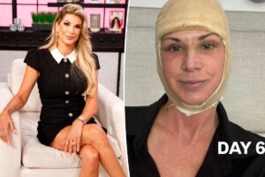‘RHOC’ alum Alexis Bellino treats herself to facelift ahead of 50th birthday
