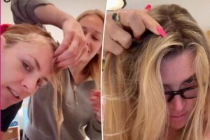 Busy Philipps shares behind-the-scenes photos from ‘f–king crazy’ brain surgery journey