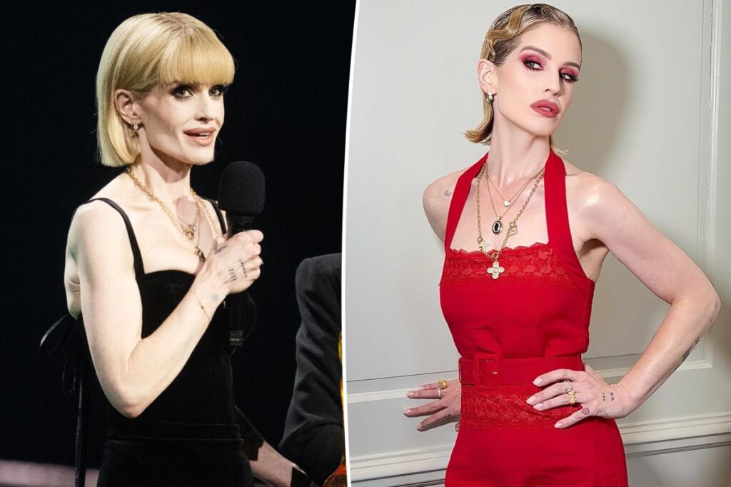 ‘Sick’ Kelly Osbourne details ‘slow process’ of recovery as she addresses body-shaming
