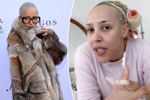 Doja Cat confesses she ‘struggled with cocaine’ and alcohol