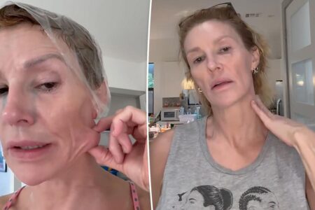 Brandi Glanville reveals slew of diagnoses as she prepares to have ‘fungal ball’ removed from her face