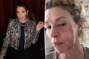 Brandi Glanville reacts to Kyle Richards’ GoFundMe donation