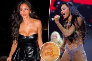 Nicole Scherzinger shows off gruesome injury after ‘boiling water’ fell on her leg 1 hour before concert